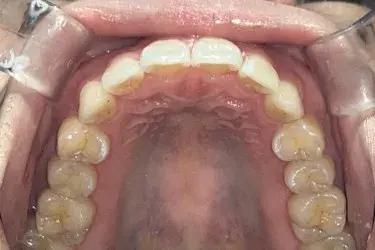 After Image