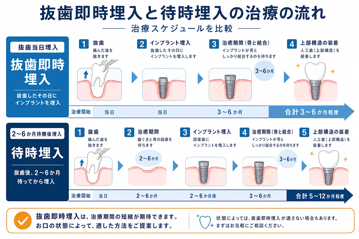 抜歯即時埋入と待時埋入の治療スケジュールを時間軸で比較した図