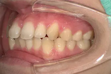 Before Image
