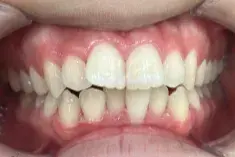 Before Image