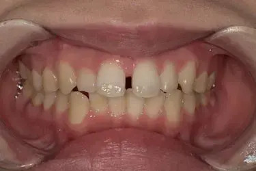 Before Image