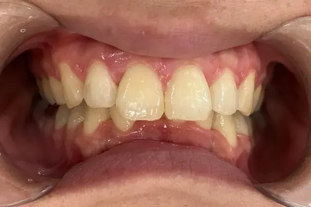 After Image