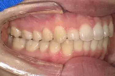 After Image