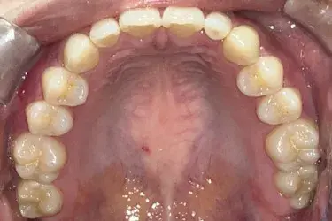 After Image