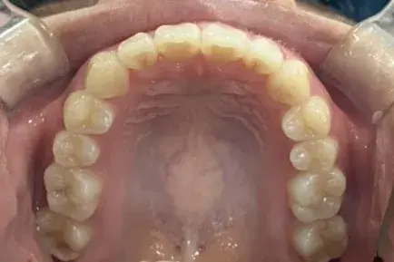 After Image