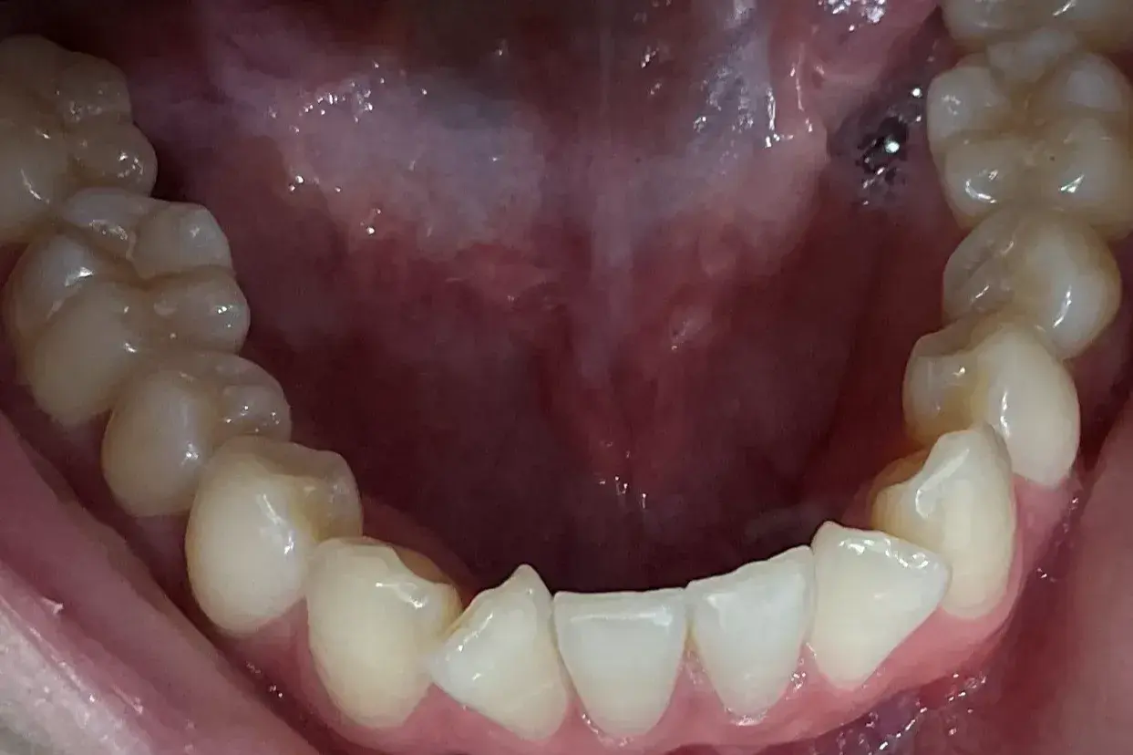 Before Image