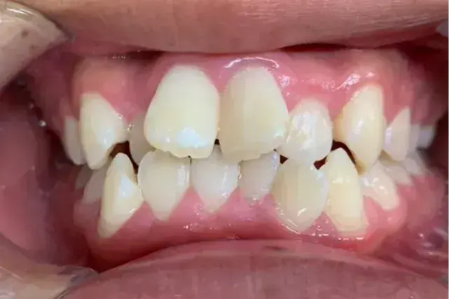 Before Image