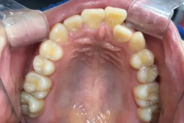 Before Image
