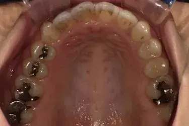 After Image