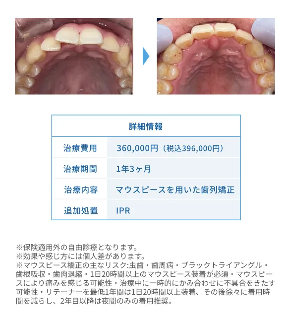 H.S.様の治療内容