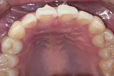 After Image