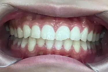 After Image