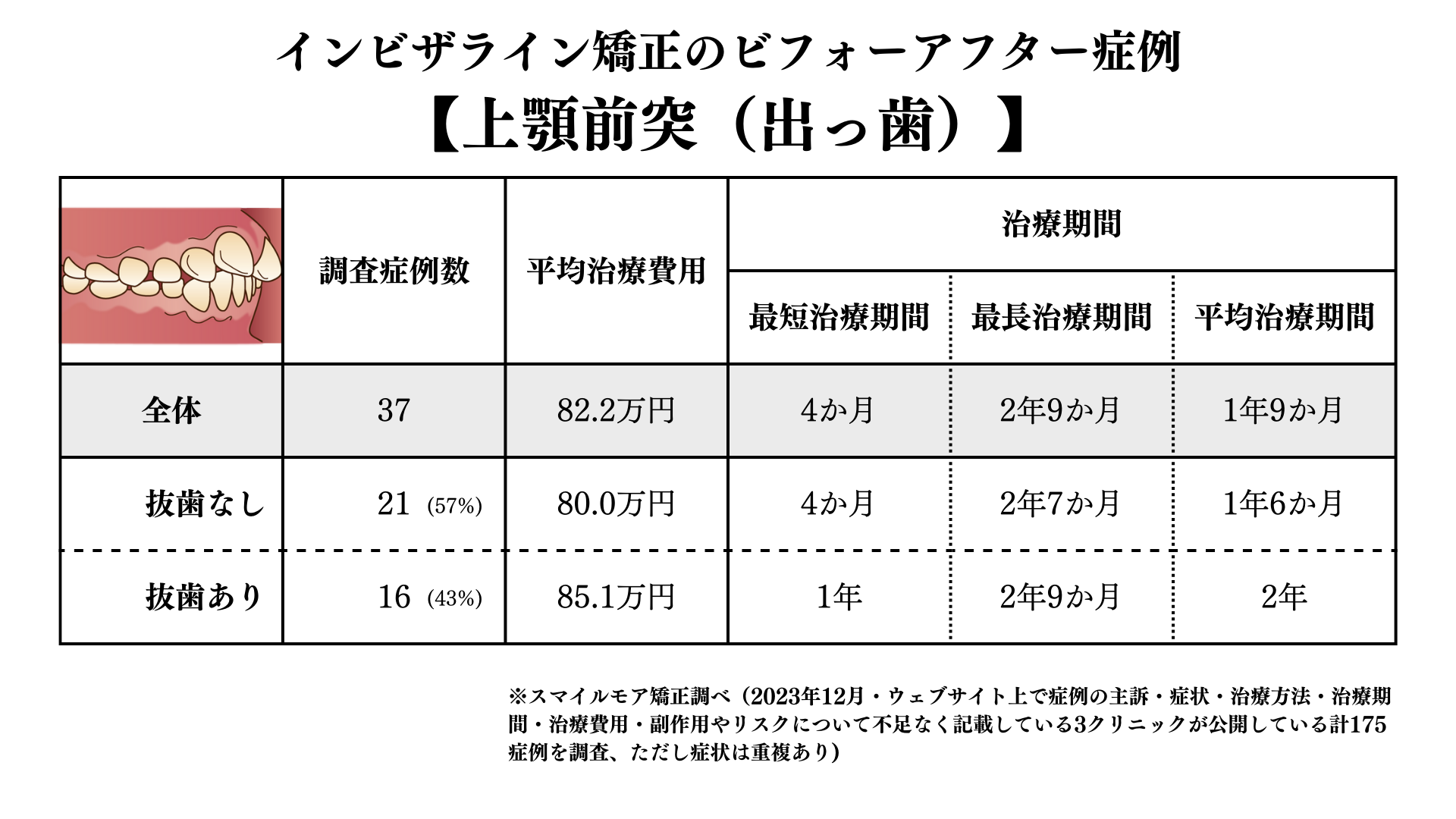 インビザライン矯正の出っ歯のビフォアーアフター症例調査結果