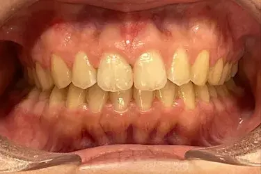 After Image