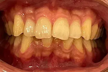 Before Image