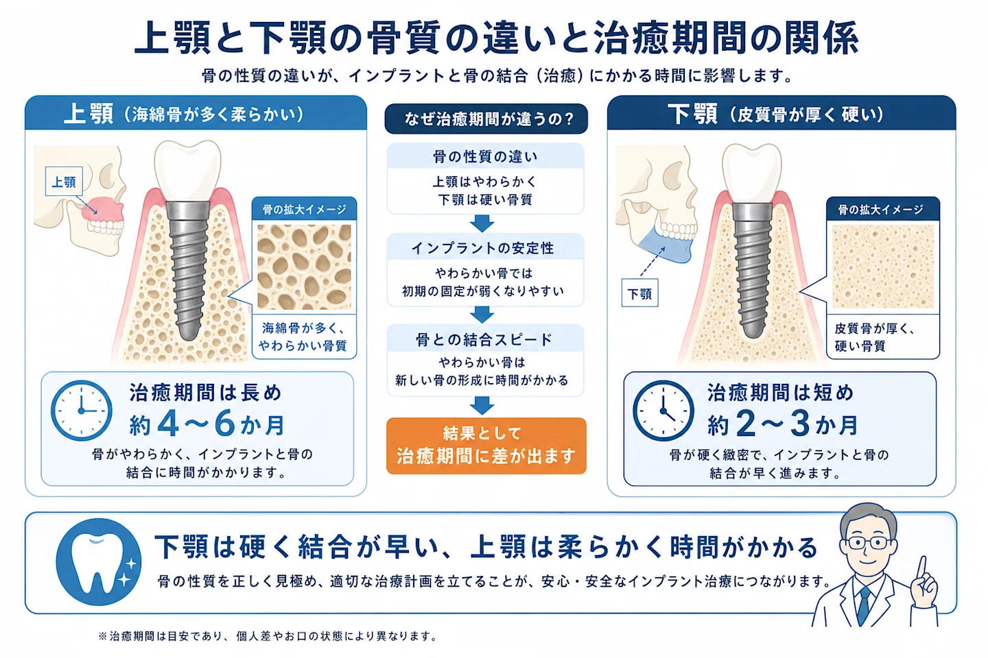 上顎と下顎の骨密度の違いを示す断面図:下顎は硬く結合が早い、上顎は柔らかく時間がかかる
