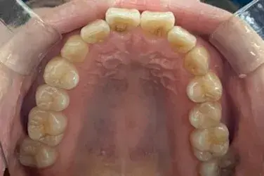 Before Image