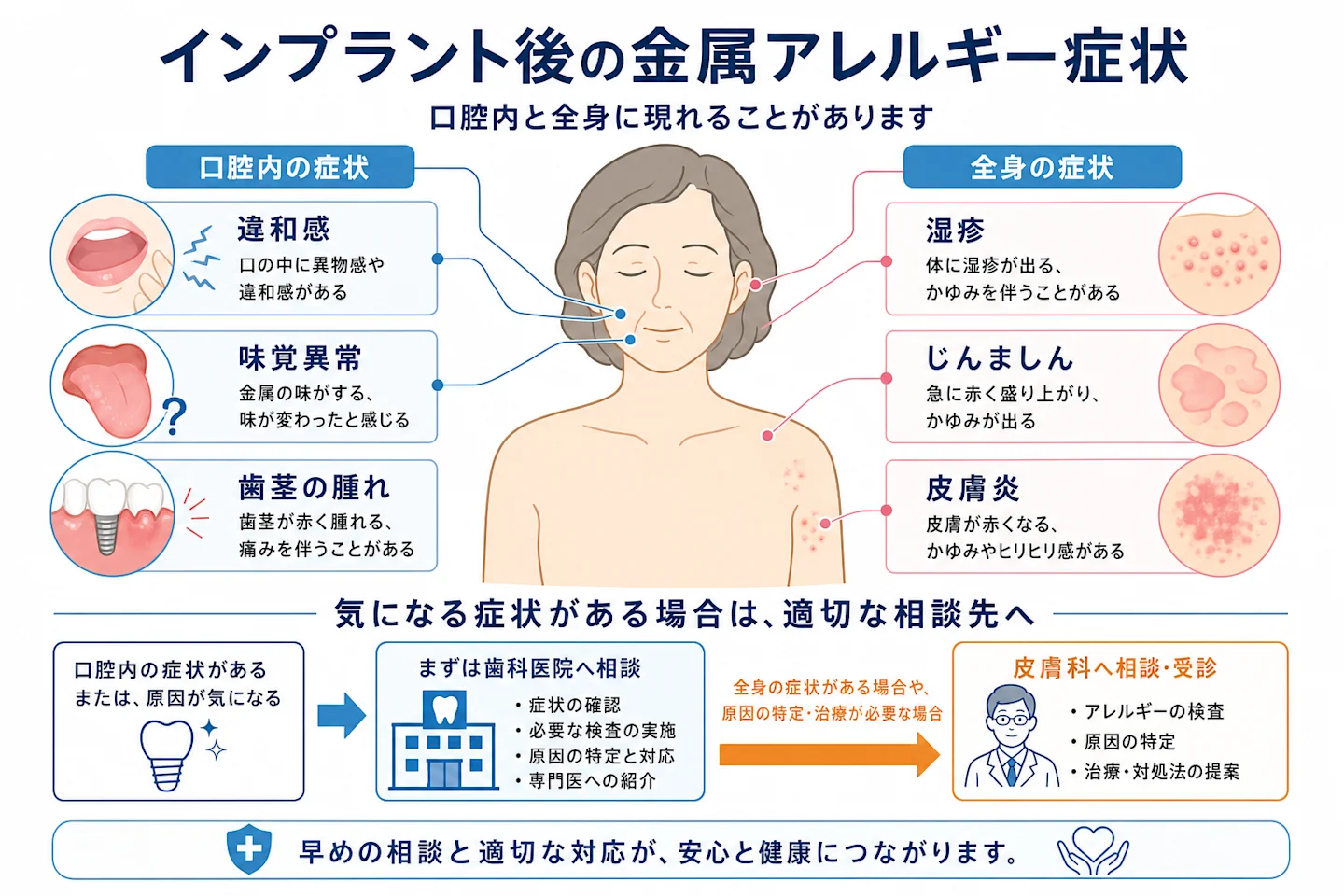 インプラント後の金属アレルギー症状を口腔内と全身に分けて示した人体イラスト