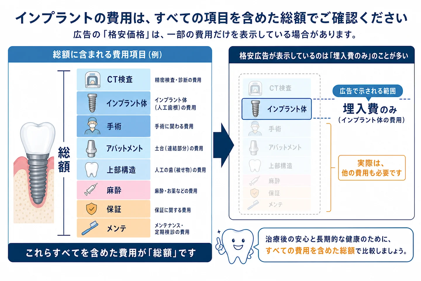 インプラント費用の内訳と格安広告が表示する範囲を比較した図