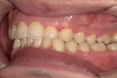 After Image