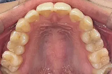 After Image