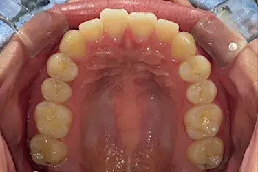 Before Image