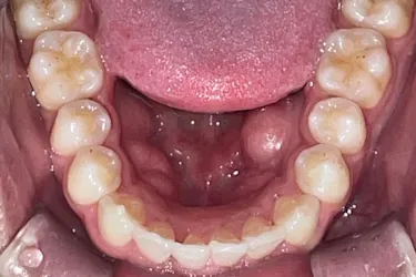 After Image