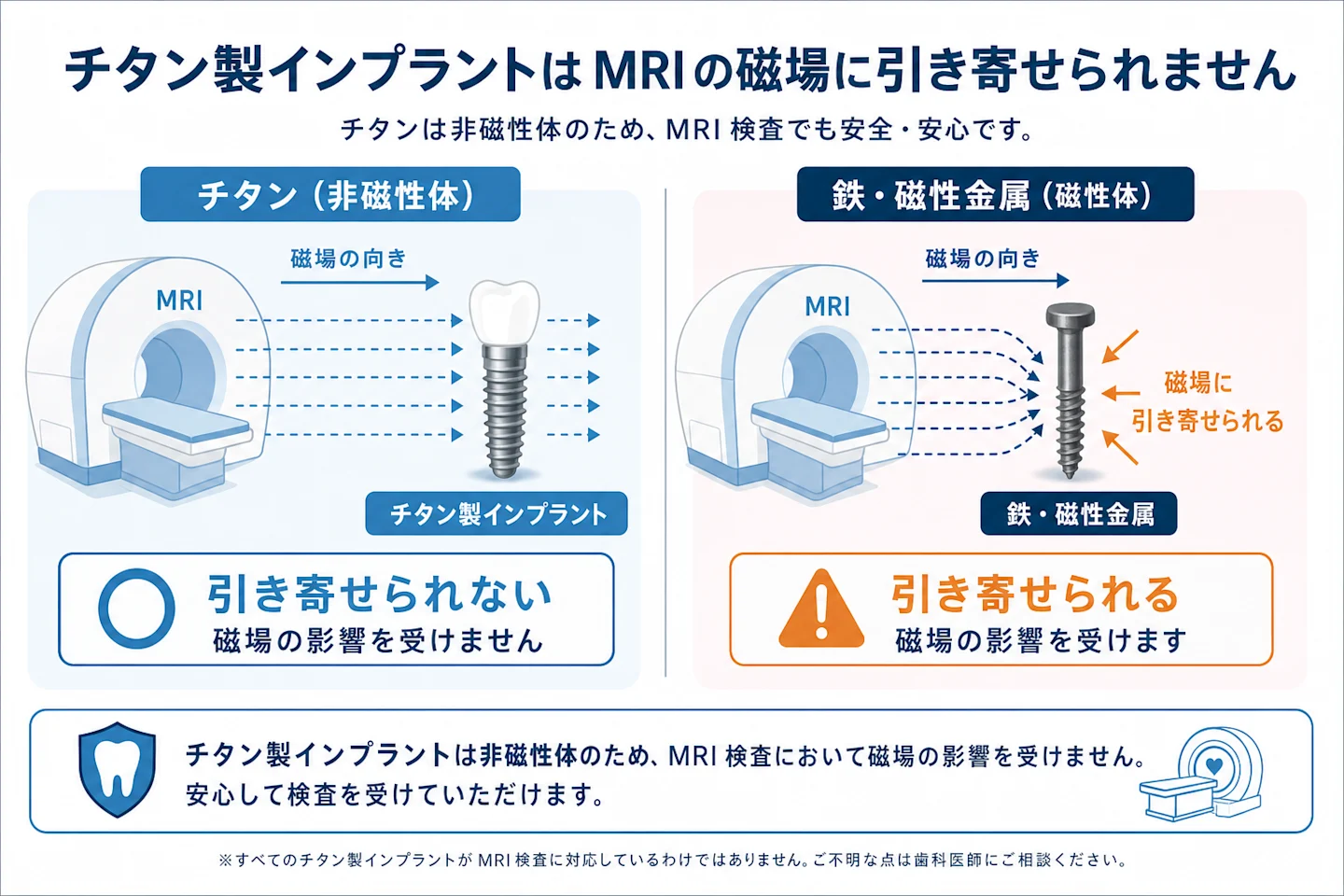 チタン製インプラントが非磁性体でMRIの磁場に引き寄せられないことを示す比較図