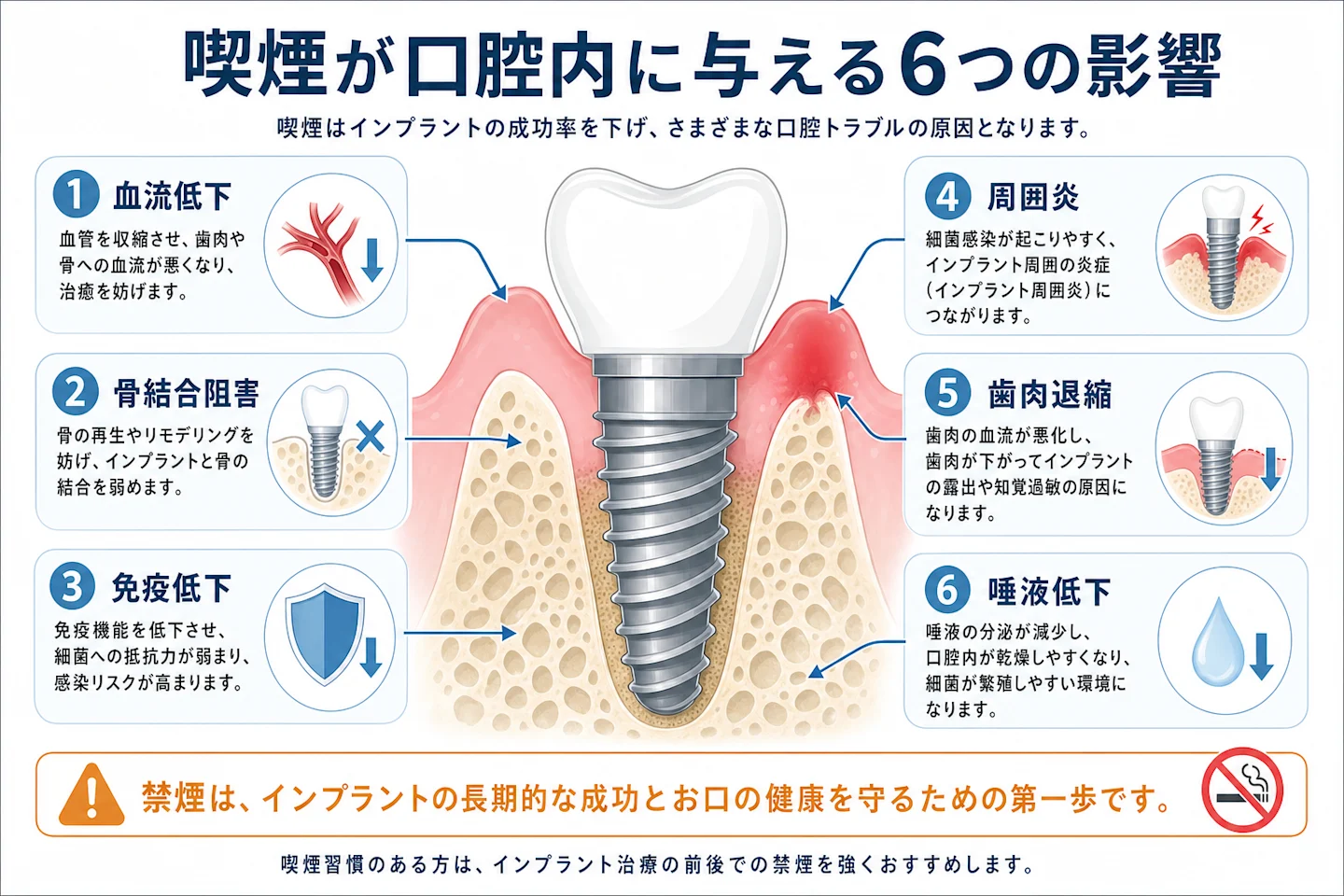 喫煙がインプラントに与える影響を示した口腔断面図解