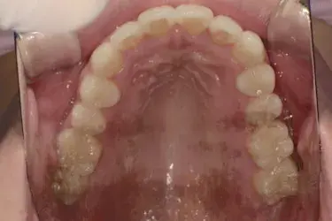 After Image