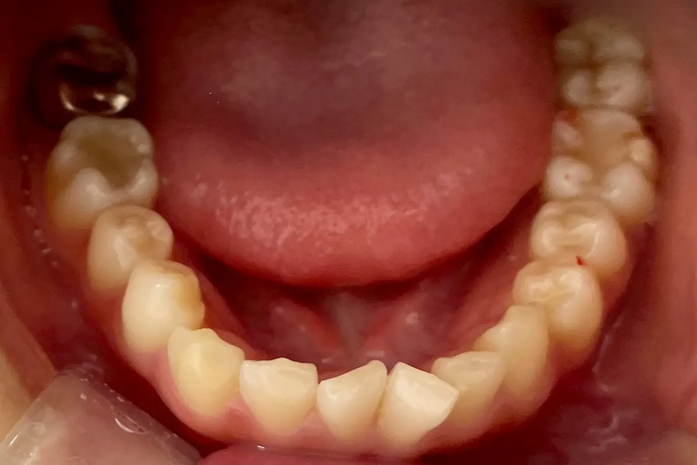 Before Image