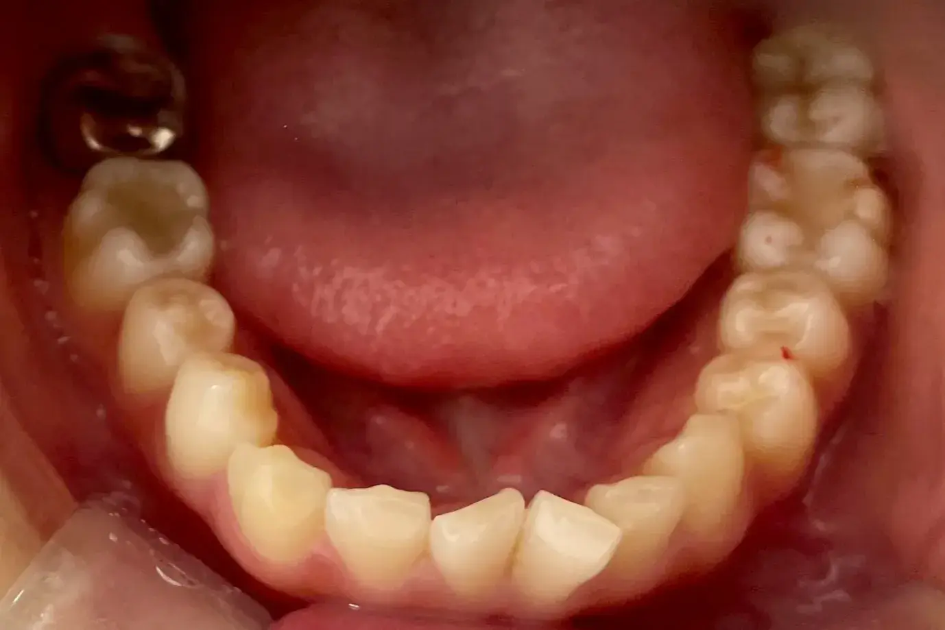 Before Image