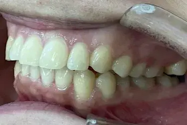 After Image