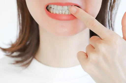 「受け口ってかわいい？」このままor治すか悩む方へ、歯科医が解説！