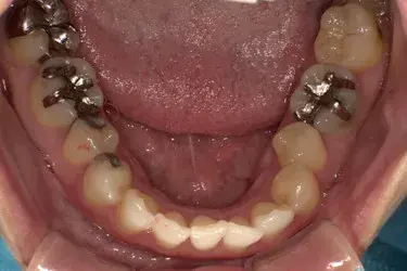 Before Image