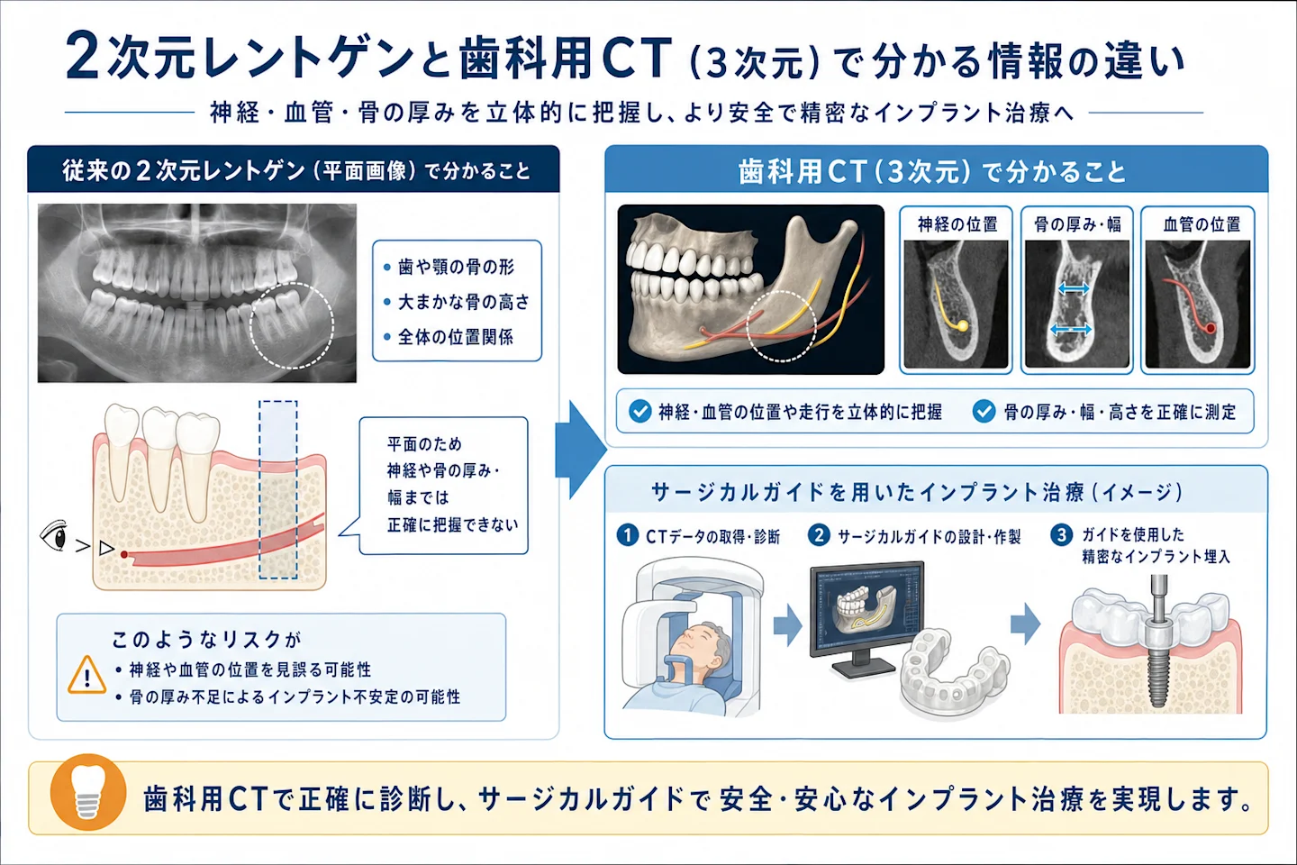 歯科用CTと従来レントゲンで把握できる顎の骨・神経の情報差を示す図解