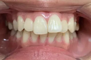 Before Image