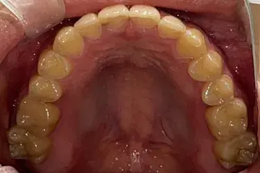 After Image
