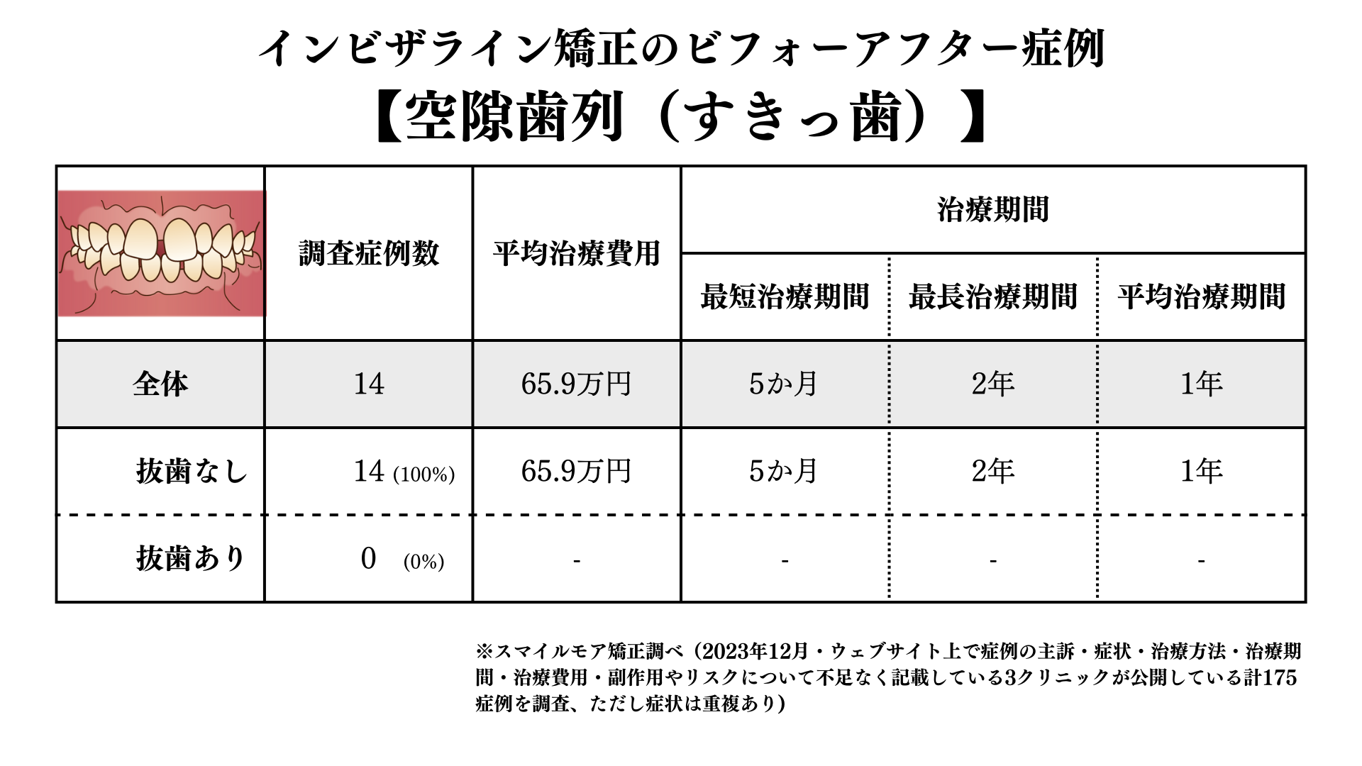 インビザライン矯正のすきっ歯のビフォアーアフター症例調査結果