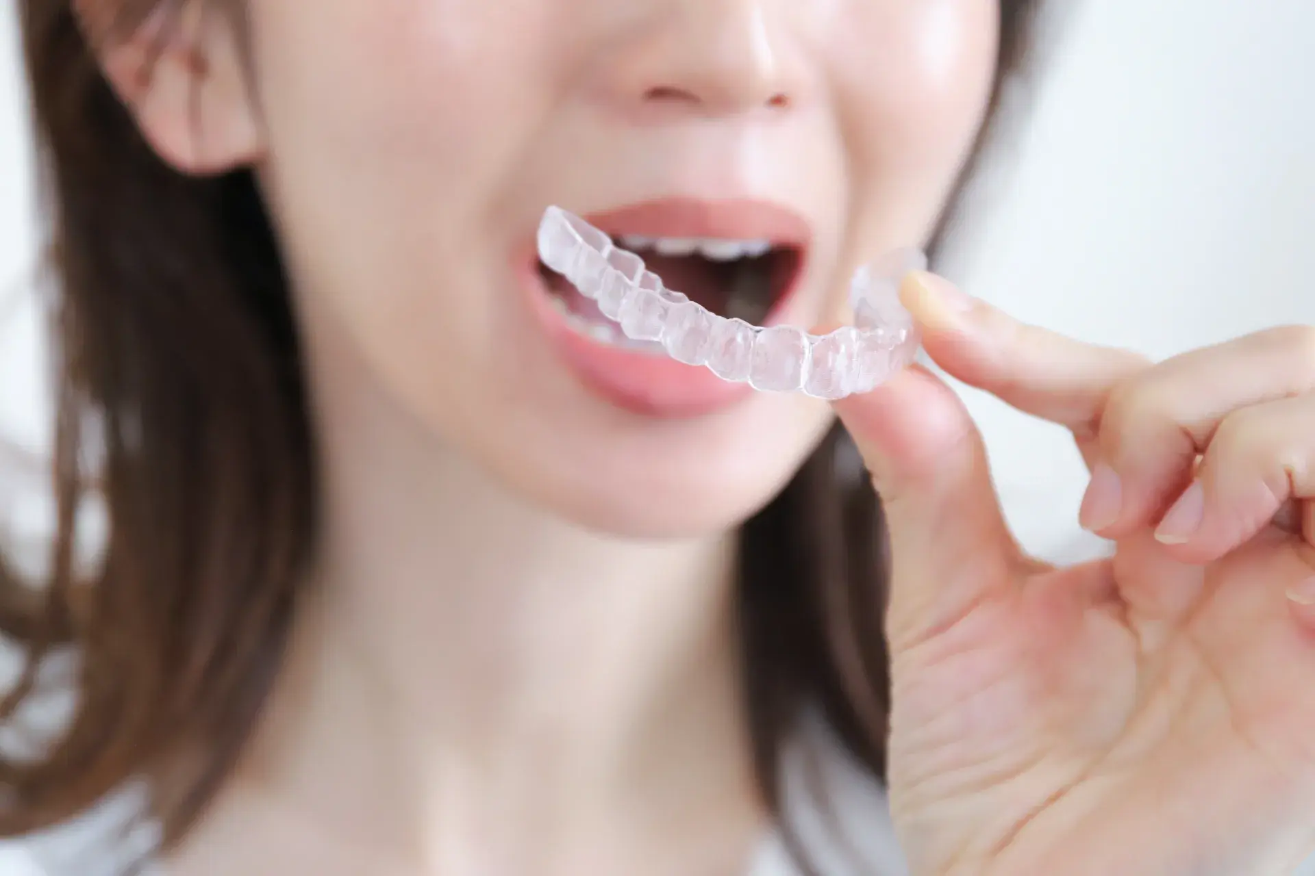 交叉咬合(クロスバイト)とは?