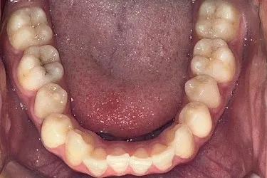 Before Image