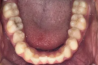 Before Image