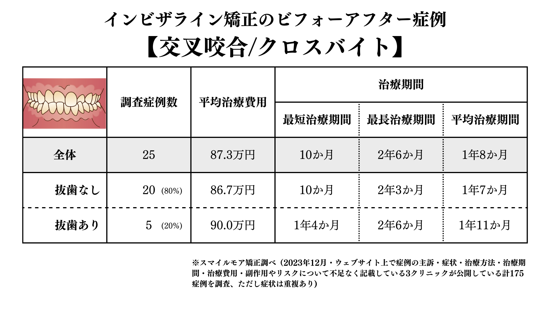 インビザライン矯正の交叉咬合のビフォアーアフター症例調査結果