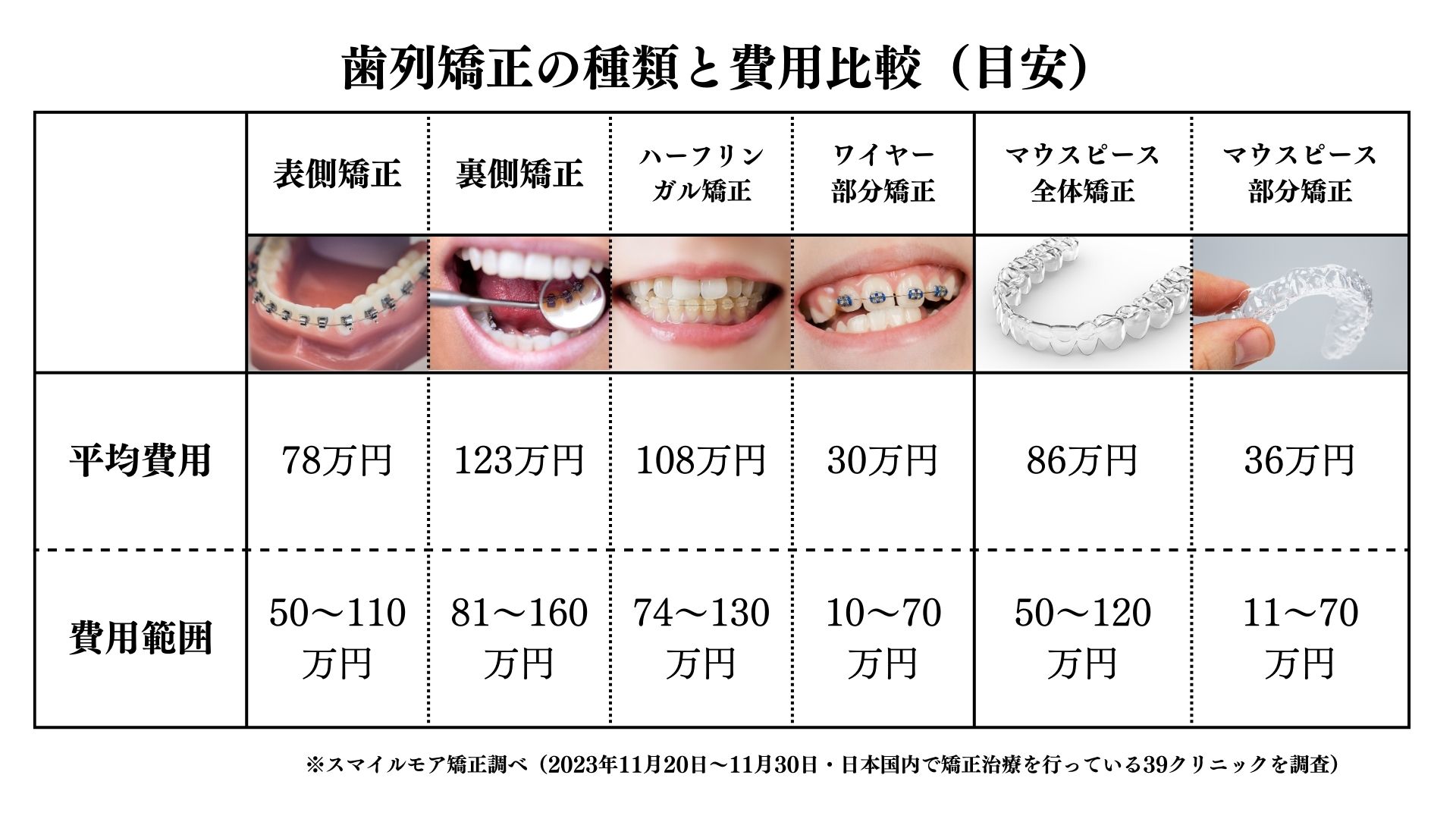 歯列矯正の種類と費用比較（目安）