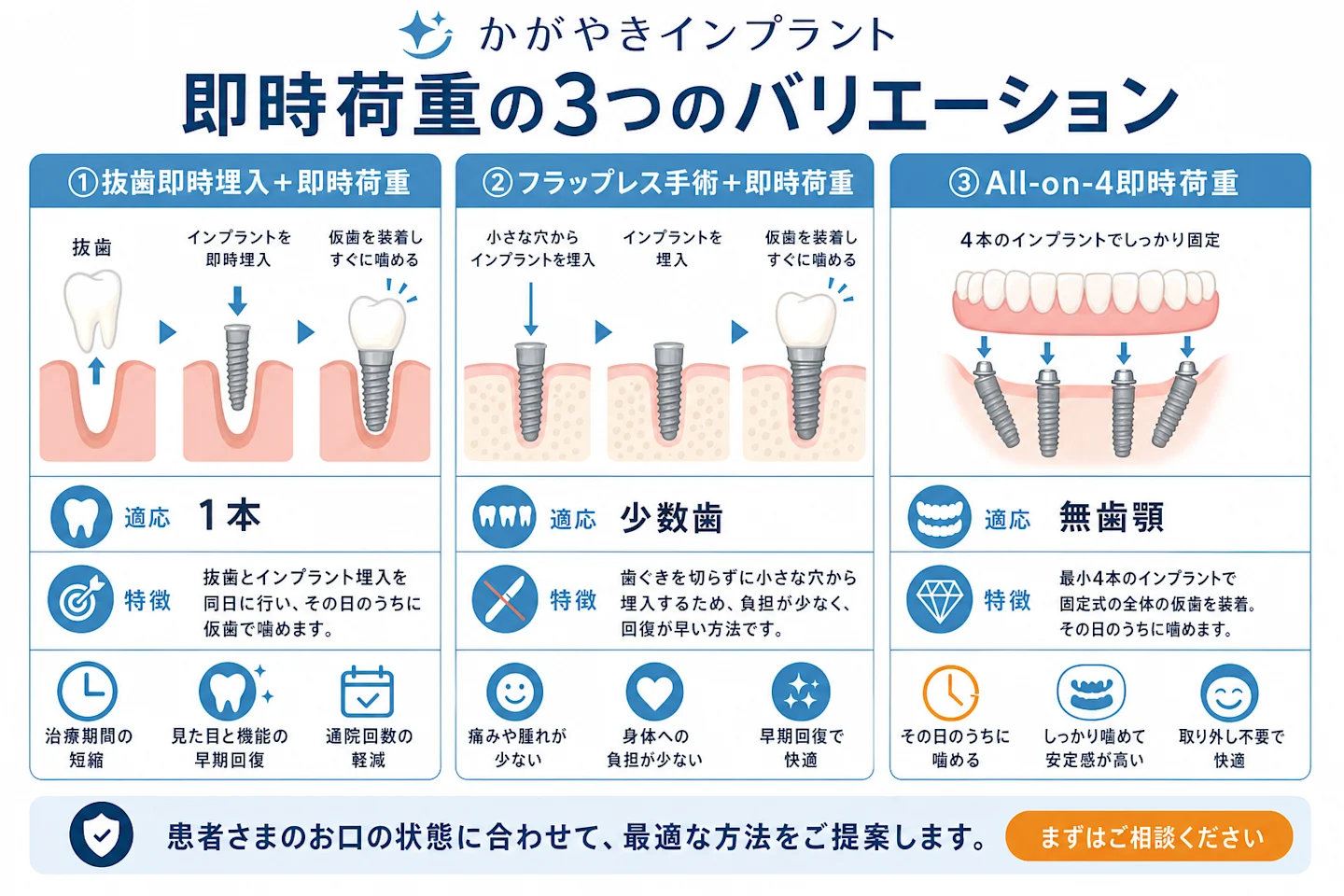 即時荷重の3つのバリエーション(抜歯即時埋入・フラップレス・All-on-4)を比較したイラスト