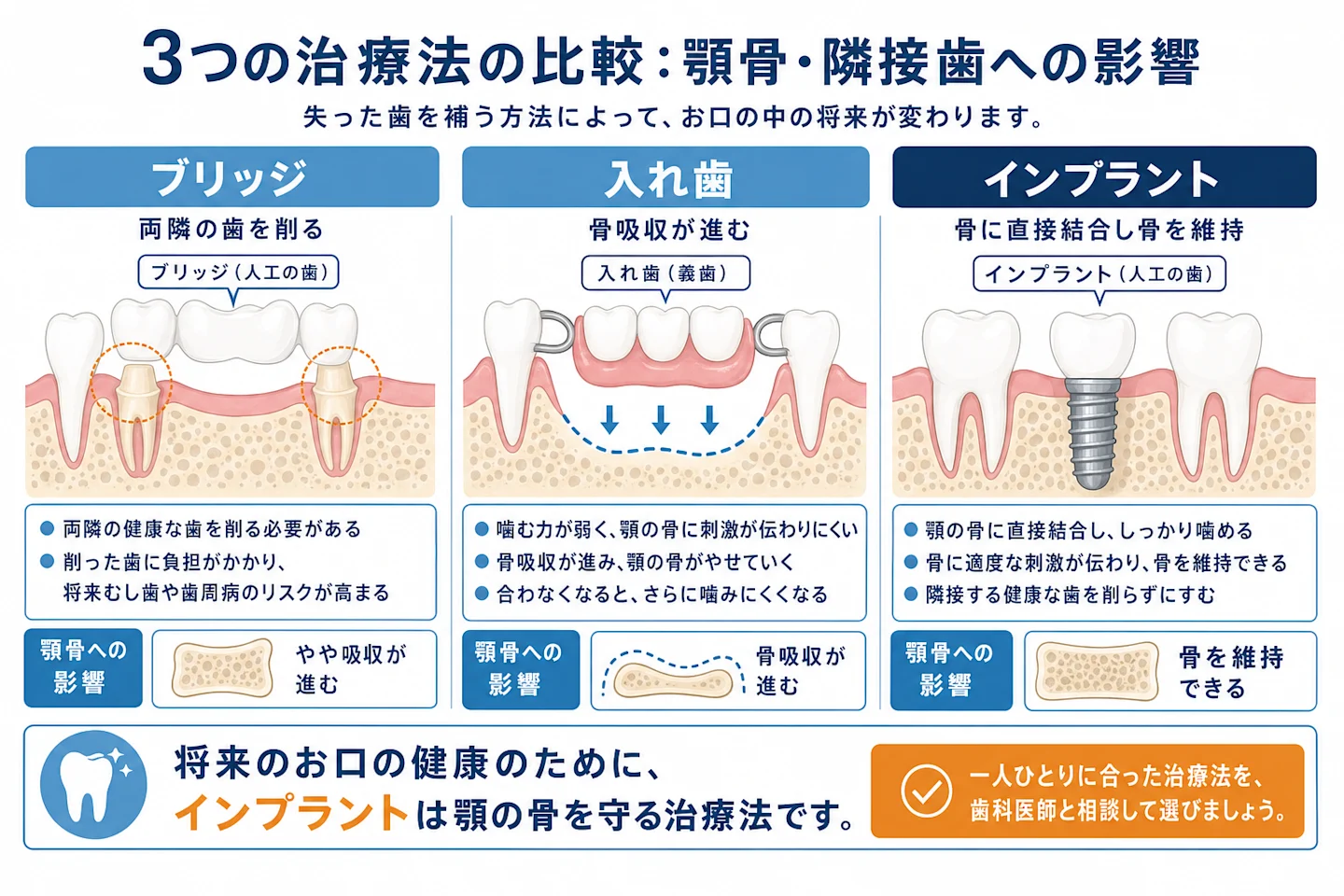 インプラント・ブリッジ・入れ歯の顎骨と隣接歯への影響比較イラスト