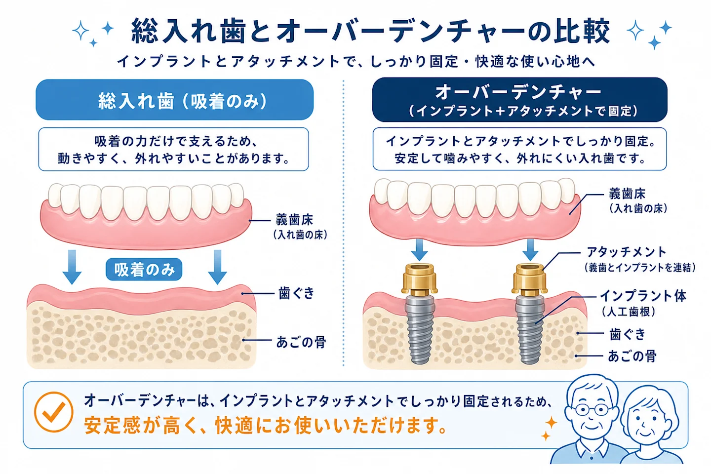 総入れ歯とオーバーデンチャーの固定構造を比較した断面図