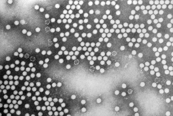 Polio virus close up