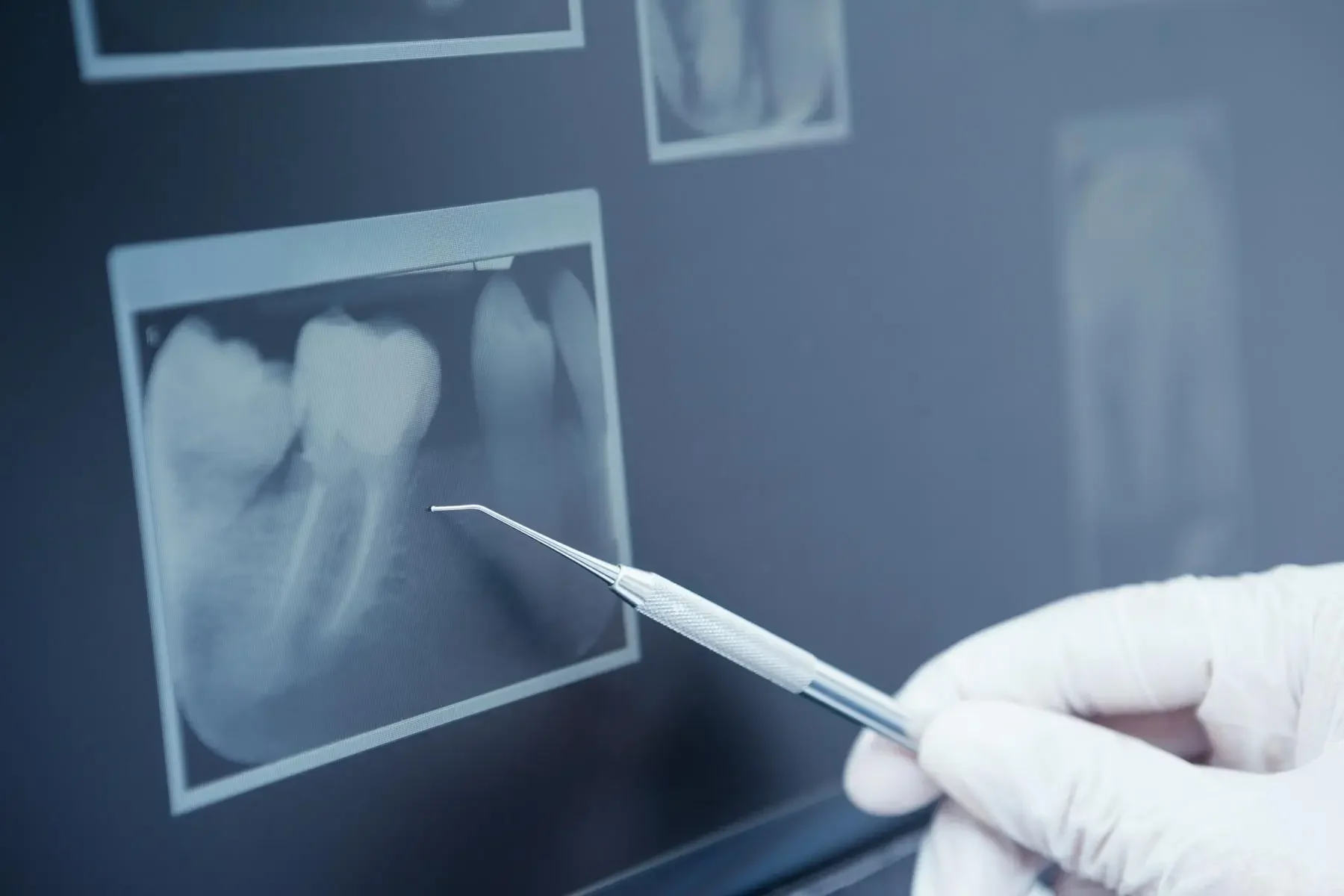 ai-dental-diagnostics-1