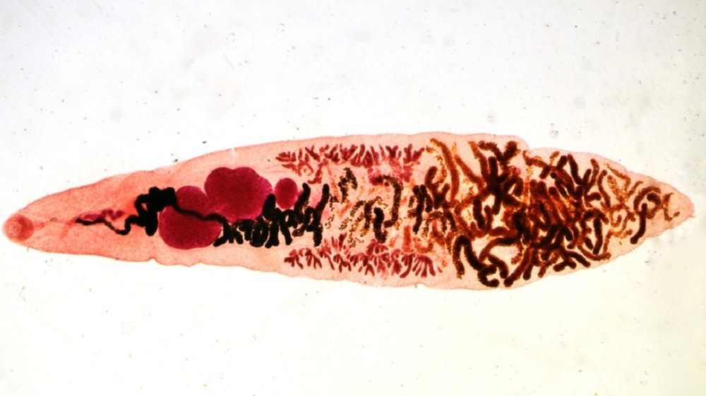 does eating tobacco kill parasites Can you 'catch' cancer? does eating tobacco kill parasites Can you 'catch' cancer?